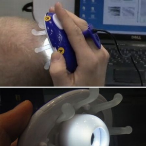頭皮觀察器